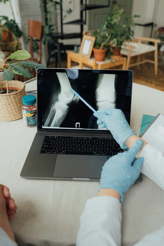 knee joint xray